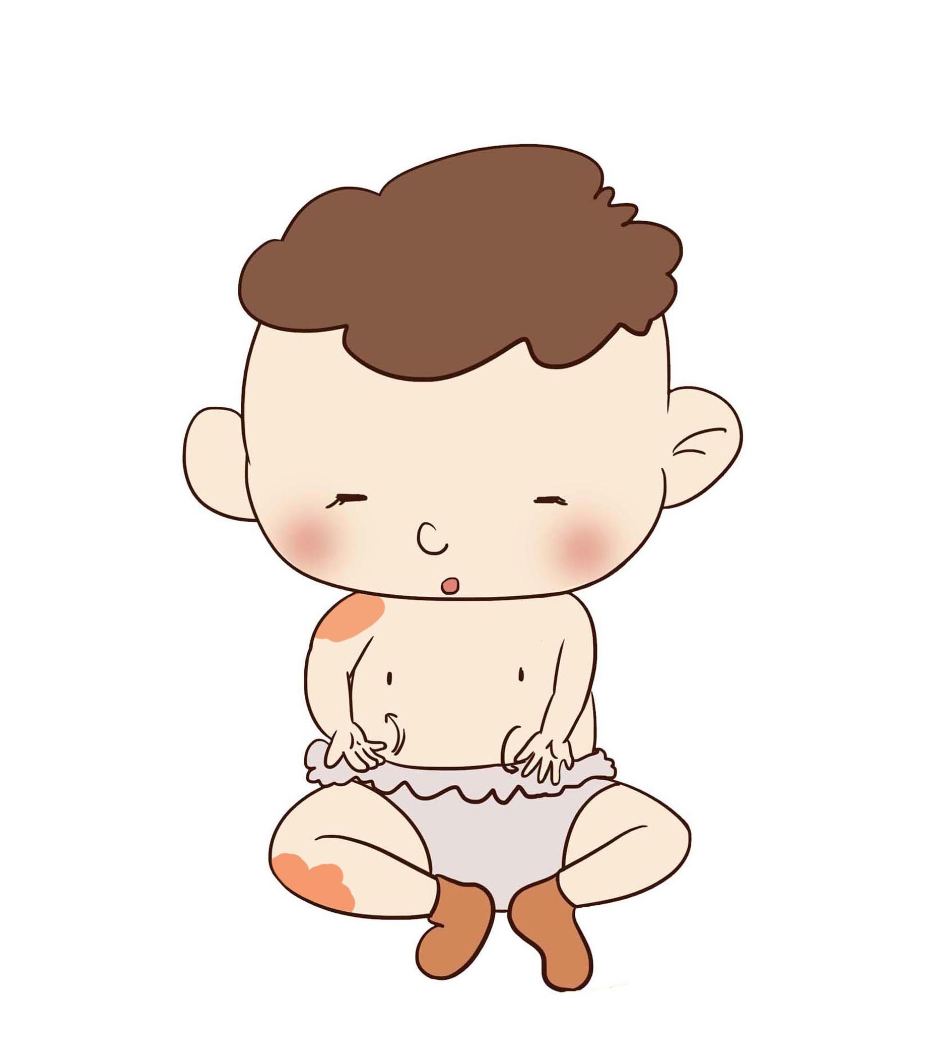 宝宝哪些胎记需要警惕,胎记修复要趁早