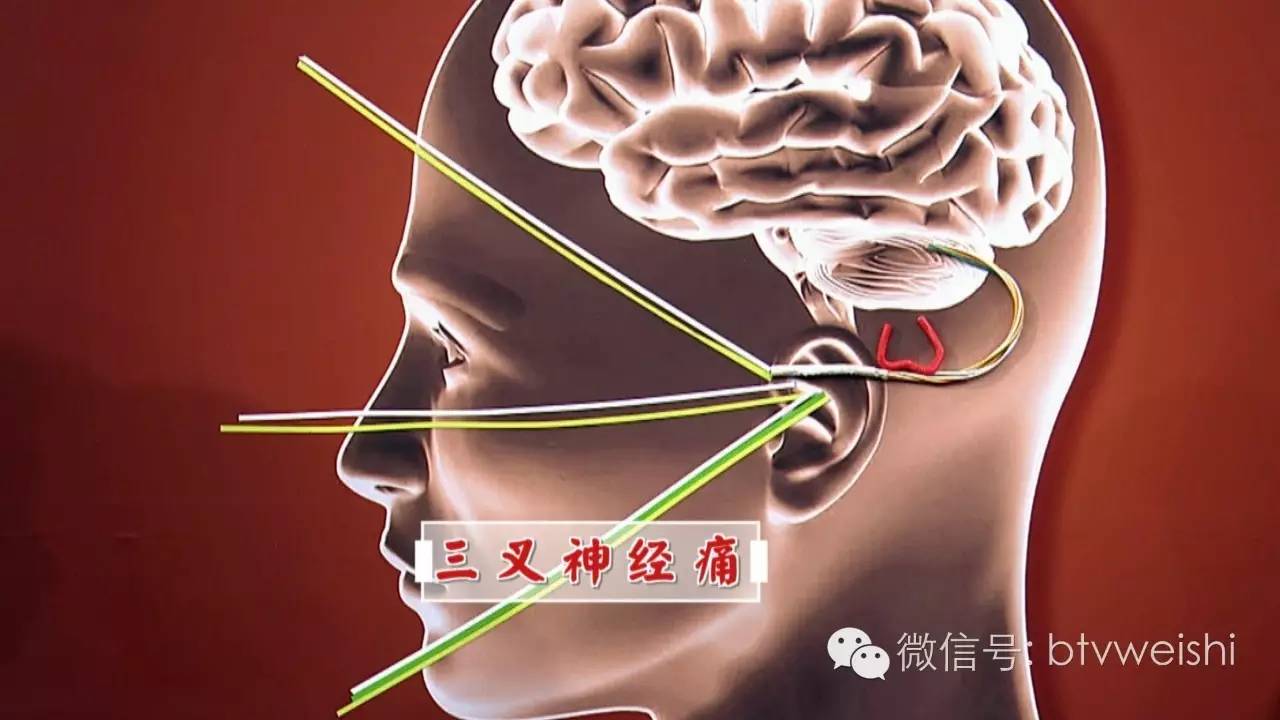 养生堂201912月15日节目完整版,养生堂2020.12.8