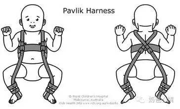 腿纹不对称但是b超正常,腿纹不对称一定有问题吗