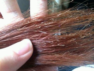 头发分叉是什么原因呢,分叉的头发还能恢复吗