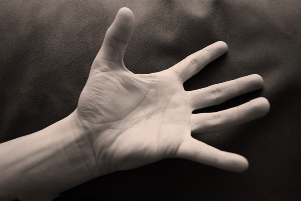 类风湿关节炎治愈率,类风湿关节炎女早期症状能治好吗