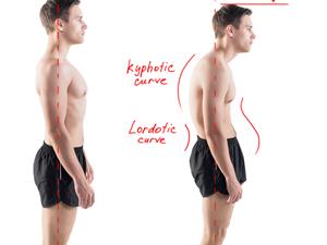驼背怎么纠正体态可以长高,驼背怎么改善身体形态