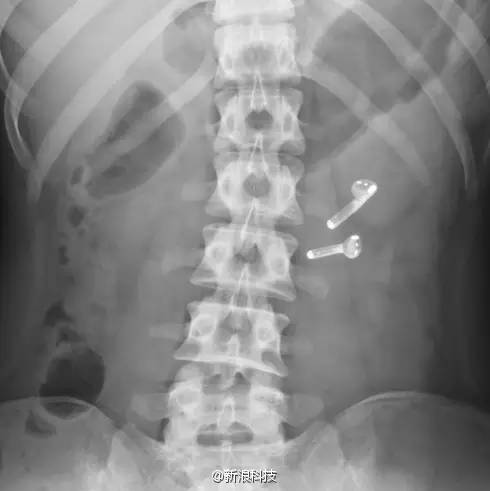 苹果反人类交互,苹果反人类操作