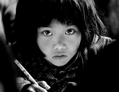 白眼球突然红了怎么处理,白眼球有一小部分变黄