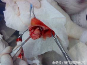 长了脂肪瘤有几种方法去掉,长了脂肪瘤怎么去除