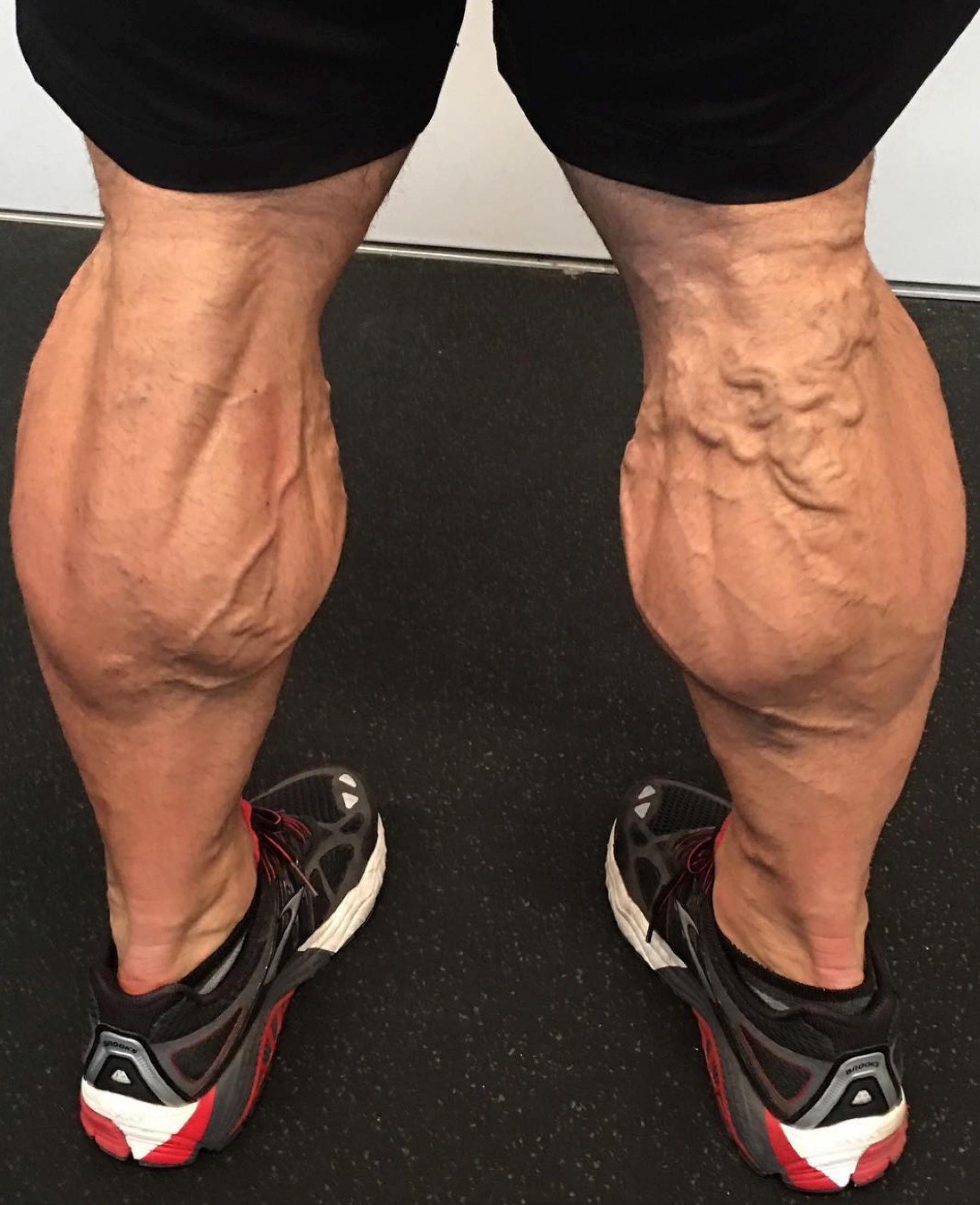 健身身上爆出来的是青筋还是血管,为什么健身的人都青筋暴起