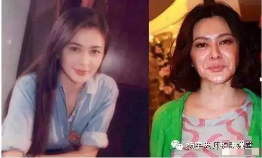 一招搞定松弛面部,脸部防松弛推荐