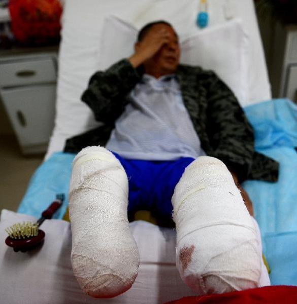 假肢公司需要什么,残疾人如何选择假肢