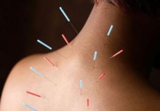 颈椎病死亡怎么抢救,针灸为什么能治疗颈椎病