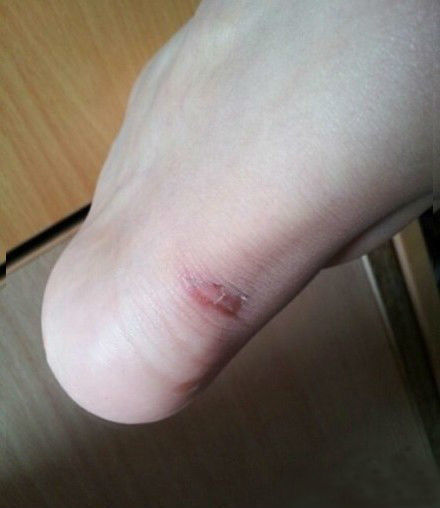 爱美的你一定有这样的血泪史，高跟鞋穿久了就会磨脚，你想解除新鞋磨脚、夹脚的苦恼吗？