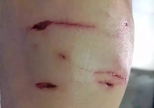 狗苗抓回来就要先打疫苗吗,买狗疫苗要打全才能买回去吗