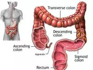 早期肠癌有4个警报,肠癌的10大危险信号