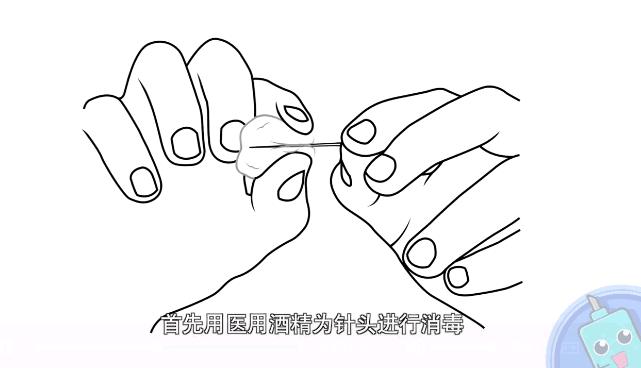 挤痘怎样才能不留痘坑,挤痘痘不留痘印的小妙招