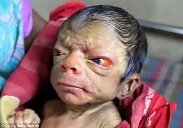 孟加拉刚出生孩子,孟加拉国婴儿现状