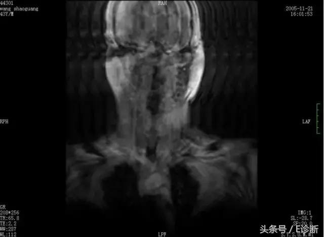 磁共振伪影及解决方案,e系列诊断