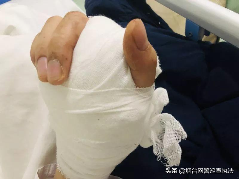 鎵嬫寚澶存嫥铻轰笣璧锋场,鎷ц灪涓濇墜涓婄牬鐨簡