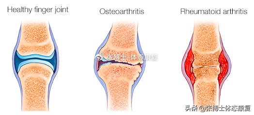 运动医学膝关节康复学知识,有关运动康复的知识