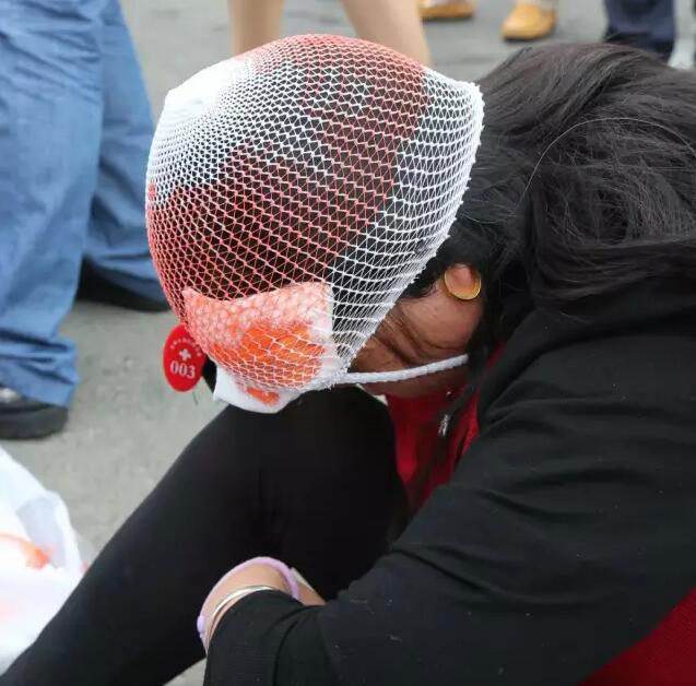 撞击导致的轻微脑震荡什么症状,撞到头部出现眩晕是怎么回事