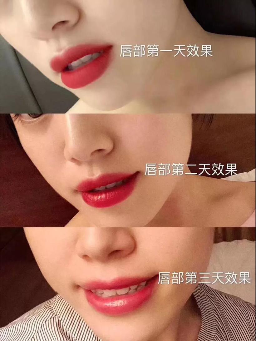 深圳传奇光学科技美容,深圳传奇光学祛斑仪器