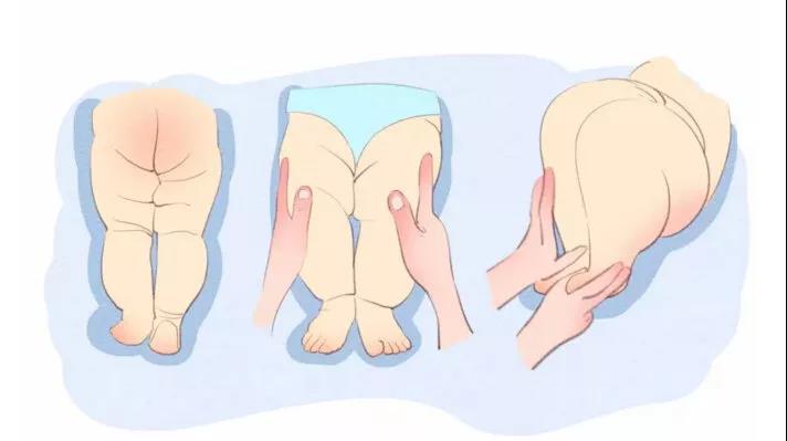 婴儿髋关节发育不良恢复操,什么是宝宝髋关节发育不良