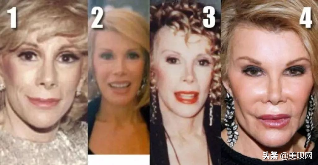 整容739次、喜剧教母、毒舌女王...麦瑟尔的原型才是真的了不起