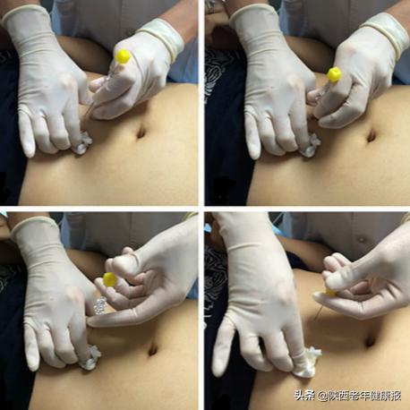 健康经络减肥,健康减肥专业指导