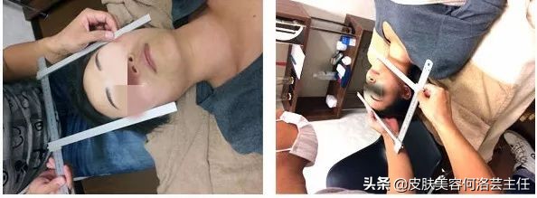 日式小颜整骨术靠谱吗,小颜整骨会有后遗症吗