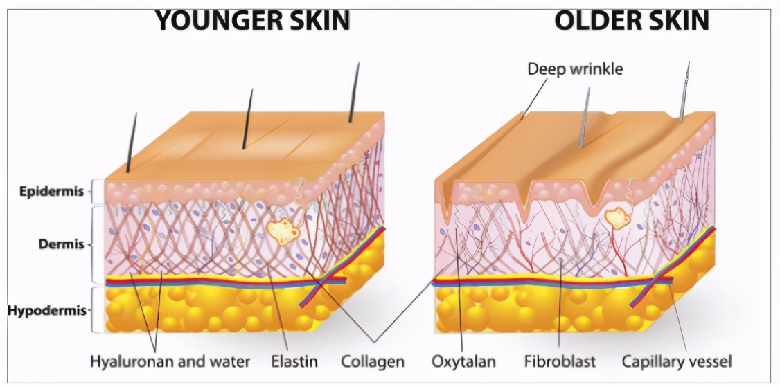 抬头纹和眼袋可以通过医美去掉吗,抬头纹很深医美上一般用什么填充