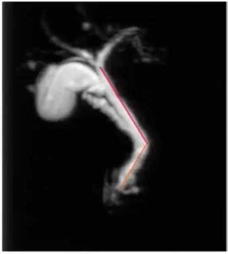 腹部ct详细讲解,腹部ct示意图及超详细教学