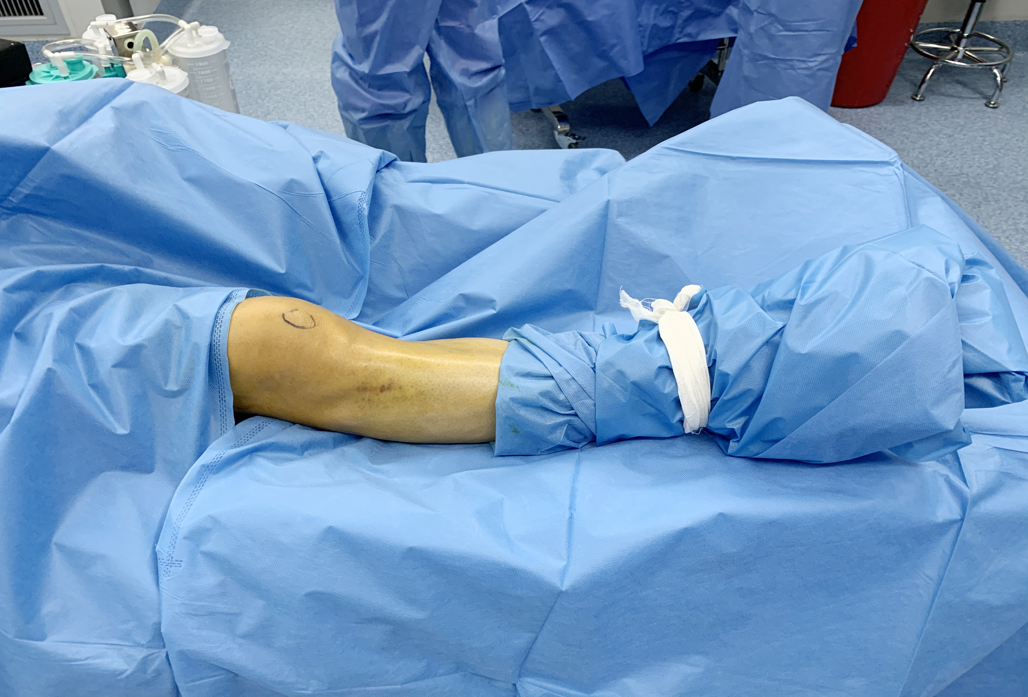 长春传染病医院艾滋病,国内首例艾滋病患儿换肾手术成功