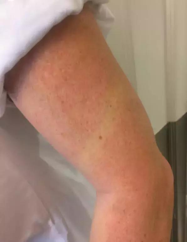 近日顶级医学期刊柳叶刀,柳叶刀医学杂志为什么影响因子高