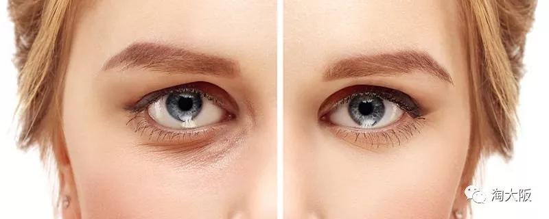 眼霜推荐去黑眼圈亲测有效,去黑眼圈的眼霜推荐最有效果的