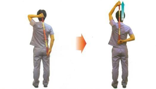 肩关节反复脱位影响干体力活吗,肩关节反复脱位核磁表现