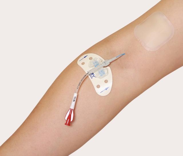 picc置管后患者可以做什么运动,中心静脉置管和picc置管的区别