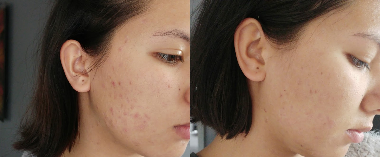 蔻诗美玫瑰果油敏感肌,澳洲koehl护肤品