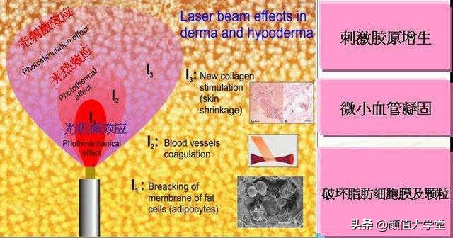 抽脂和吸脂后有什么注意事项,吸脂手术的危害和后遗症