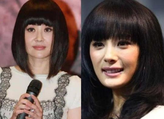 脸太大有什么方法变小吗,脸太大怎么让脸变小整形