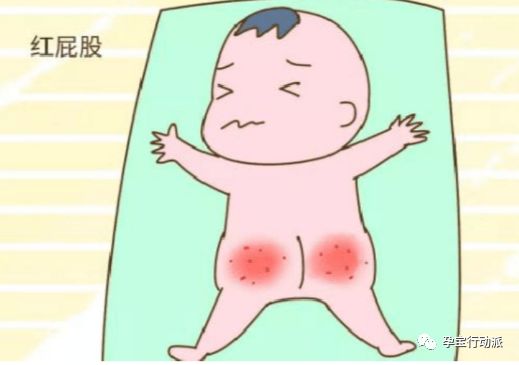 宝宝红pp是什么原因,宝宝红pp什么原因