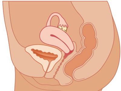 孕妈妈胎动太明显了,准妈妈为什么会出现胎动