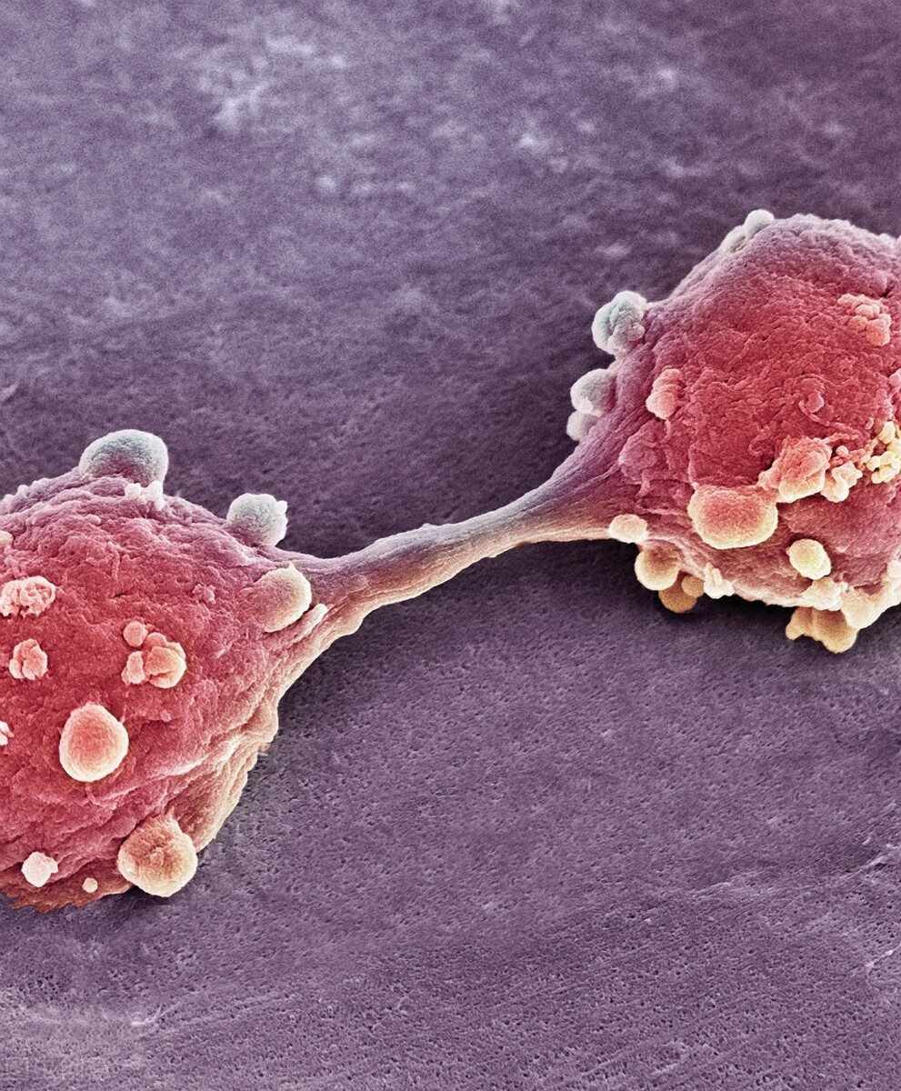 尿频总跑厕所是肾不好？辟谣：导致尿频的10种病因，一一说清