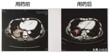 国产929客机,国产靶向药9291
