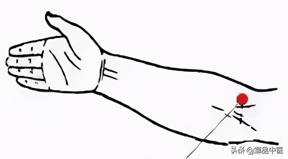 中医经络平衡介入疗法,经络是如何调节人体阴阳平衡的