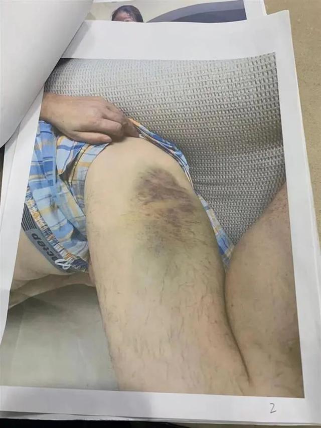 投诉民警被传唤女子：当众被铐上警车很屈辱，警方想上门跟我沟通来道歉，失去工作担心以后生活受影响