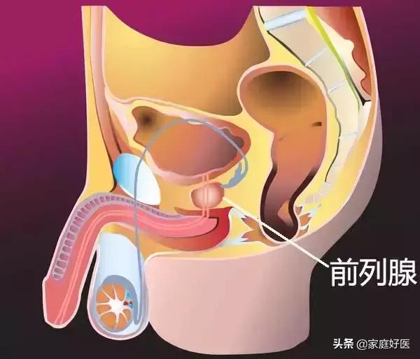 男人怕前列腺炎吗,男人怕前列腺炎女人怕什么