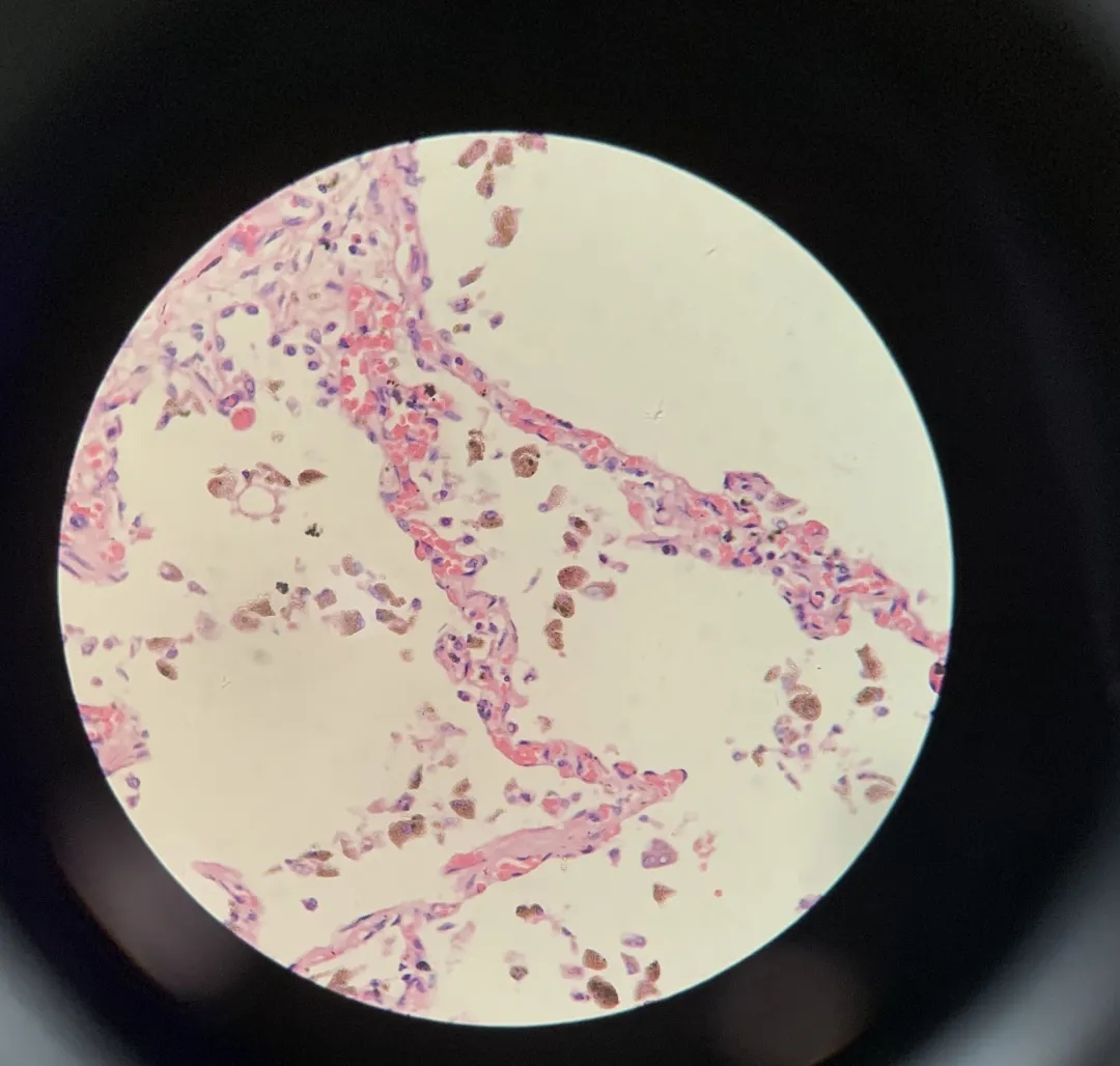 医学生学习打卡做题,医学生学习成果检验视频