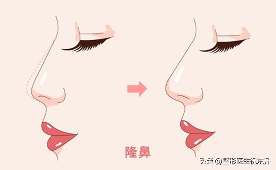 聊一聊做过后悔的医美项目,这几年做医美的真实感受