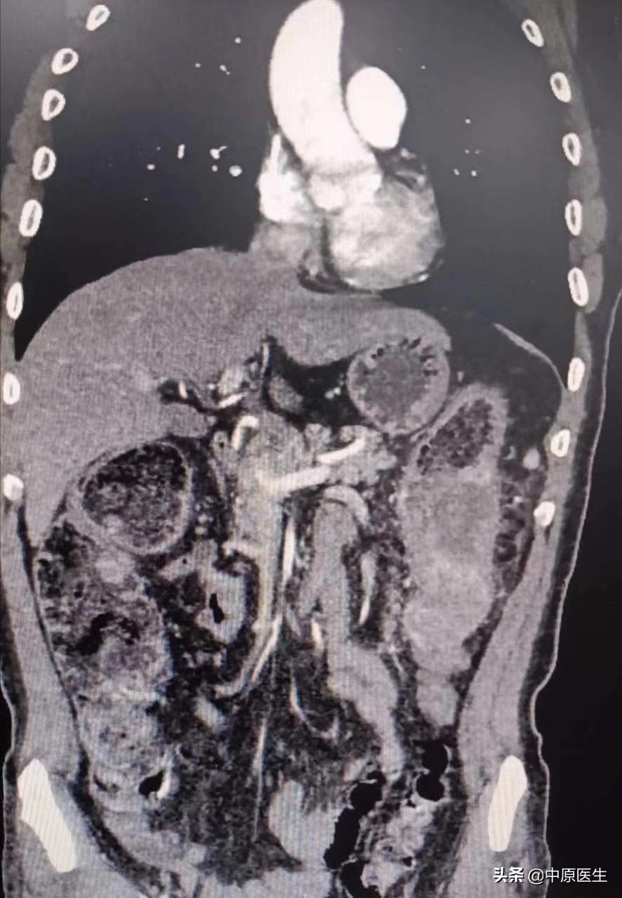 手术室没想象中的那么可怕,手术室没有想象的那么可怕