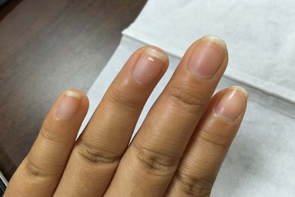 手脚有轻微的发麻怎么缓解,头发麻手脚发麻一整天是怎么回事