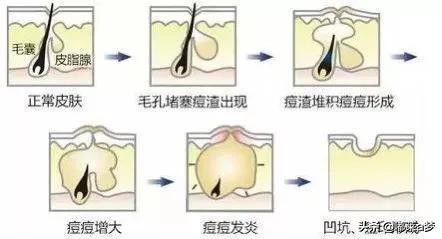先控油还是先爽肤,先控油还是先修复