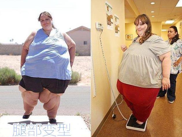俩女人，一个身材臃肿，一个身材窈窕，生育时的差距一目了然